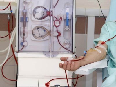 dialysis-can-carry-out-the-function-of-the-kidneys